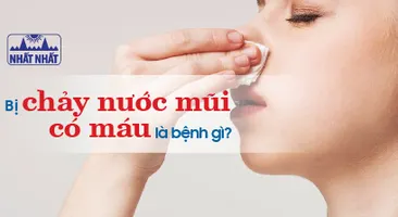 Bị chảy nước mũi có máu là bệnh gì? Có nguy hiểm không?