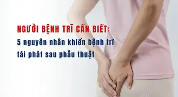 Người bệnh trĩ cần biết: 5 nguyên nhân khiến bệnh trĩ tái phát sau phẫu thuật
