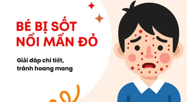 Bé bị sốt nổi mẩn đỏ: Giải đáp chi tiết, tránh hoang mang
