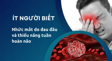 Ít người biết nhức mắt do đau đầu và thiểu năng tuần hoàn não