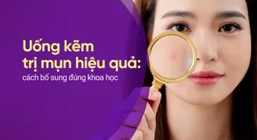 Uống kẽm trị mụn hiệu quả: cách bổ sung đúng khoa học