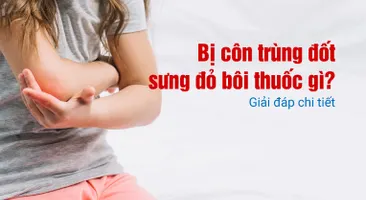 Bị côn trùng đốt sưng đỏ bôi thuốc gì? Giải đáp chi tiết