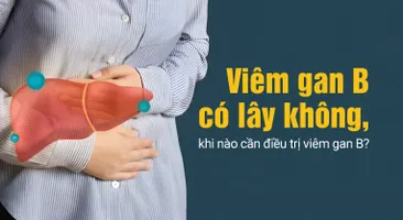 Viêm gan B có lây không, khi nào cần điều trị viêm gan B?