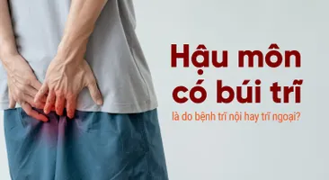 Hậu môn có búi trĩ là do bệnh trĩ nội hay trĩ ngoại?