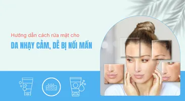 Hướng dẫn cách rửa mặt cho da nhạy cảm, dễ bị nổi mẩn