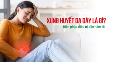 Xung huyết dạ dày là gì? Biện pháp điều trị cần nắm rõ