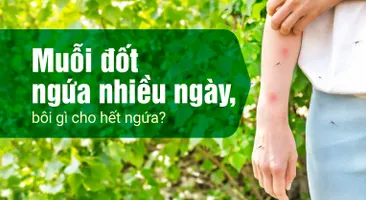 Muỗi đốt ngứa nhiều ngày, bôi gì cho hết ngứa?