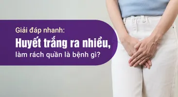 Giải đáp nhanh: Huyết trắng ra nhiều, làm rách quần là bệnh gì?