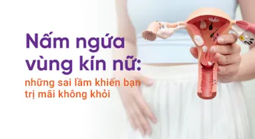 Nấm ngứa vùng kín nữ: những sai lầm khiến bạn trị mãi không khỏi