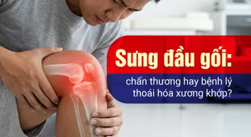 Sưng đầu gối: chấn thương hay bệnh lý thoái hóa xương khớp?