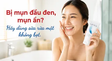 Bị mụn đầu đen, mụn ẩn? Hãy dùng sữa rửa mặt không bọt