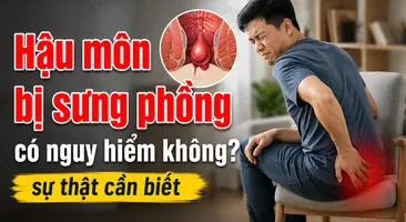 Hậu môn bị sưng phồng có nguy hiểm không? sự thật cần biết