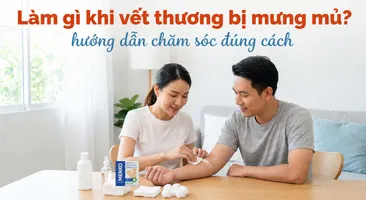 Làm gì khi vết thương bị mưng mủ? hướng dẫn chăm sóc đúng cách