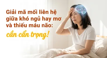 Giải mã mối liên hệ giữa khó ngủ hay mơ và thiếu máu não: cần cẩn trọng!