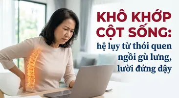 Khô khớp cột sống: hệ lụy từ thói quen ngồi gù lưng, lười đứng dậy
