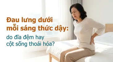 Đau lưng dưới mỗi sáng thức dậy: do đĩa đệm hay cột sống thoái hóa?