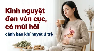 Kinh nguyệt đen vón cục, có mùi hôi: cảnh báo khí huyết ứ trệ