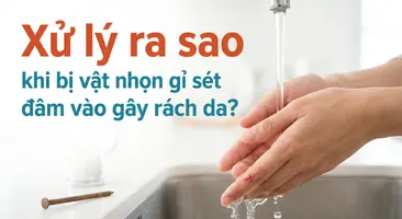 Xử lý ra sao khi bị vật nhọn gỉ sét đâm vào gây rách da?