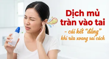 Dịch mủ tràn vào tai - cái kết "đắng" khi rửa xoang sai cách