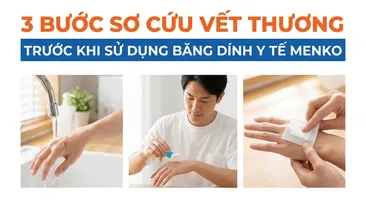 3 bước sơ cứu vết thương trước khi sử dụng Băng dính y tế MENKO