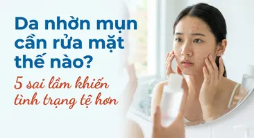 Da nhờn mụn cần rửa mặt thế nào? 5 sai lầm khiến tình trạng tệ hơn