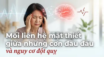 Mối liên hệ mật thiết giữa những cơn đau đầu và nguy cơ đột quỵ