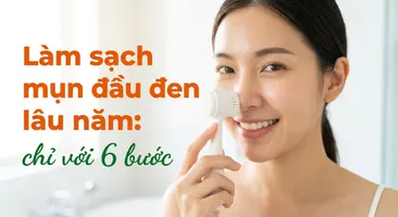 Làm sạch mụn đầu đen lâu năm: chỉ với 6 bước