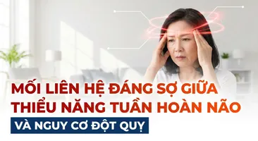 Mối liên hệ đáng sợ giữa thiểu năng tuần hoàn não và nguy cơ đột quỵ