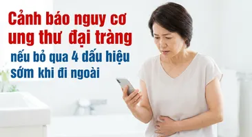Cảnh báo nguy cơ ung thư đại tràng nếu bỏ qua 4 dấu hiệu sớm khi đi ngoài