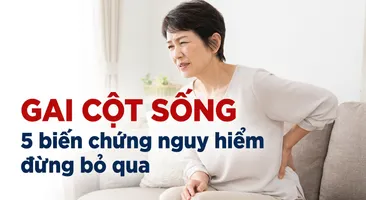 Gai cột sống: 5 biến chứng nguy hiểm đừng bỏ qua