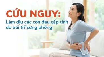 Cứu nguy: làm dịu các cơn đau cấp tính do búi trĩ sưng phồng