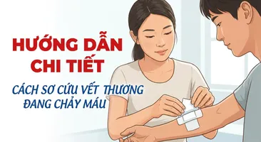 Hướng dẫn chi tiết cách sơ cứu vết thương đang chảy máu