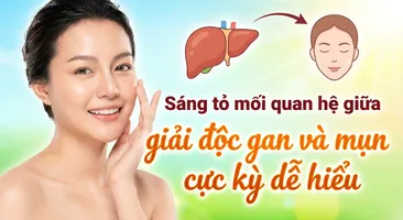 Sáng tỏ mối quan hệ giữa giải độc gan và mụn cực kỳ dễ hiểu
