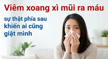 Viêm xoang xì mũi ra máu - sự thật phía sau khiến ai cũng giật mình