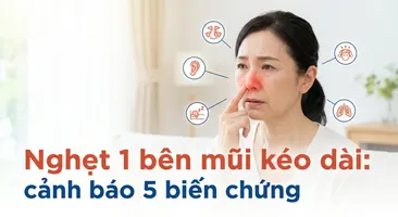 Nghẹt 1 bên mũi kéo dài: cảnh báo 5 biến chứng