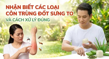 Nhận biết các loại côn trùng đốt sưng to và cách xử lý đúng