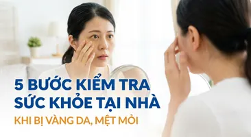 5 bước kiểm tra sức khỏe tại nhà khi bị vàng da, mệt mỏi