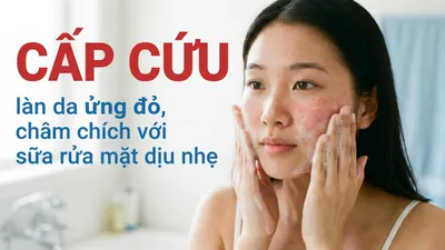 "Cấp cứu" làn da ửng đỏ, châm chích với sữa rửa mặt dịu nhẹ