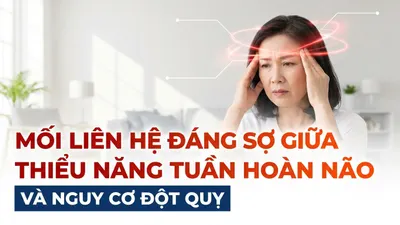 Mối liên hệ đáng sợ giữa thiểu năng tuần hoàn não và nguy cơ đột quỵ