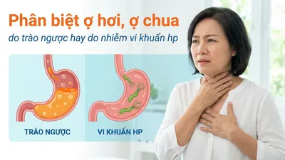 Phân biệt ợ hơi, ợ chua do trào ngược hay do nhiễm vi khuẩn hp
