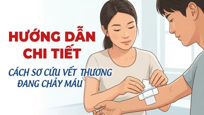 Hướng dẫn chi tiết cách sơ cứu vết thương đang chảy máu