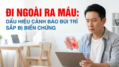 Đi ngoài ra máu: dấu hiệu cảnh báo búi trĩ sắp bị biến chứng
