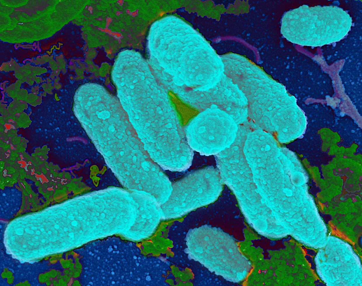 Vi khuẩn Haemophilus influenzae tuýp B là một trong những nguyên nhân gây nên viêm đường hô hấp trên
