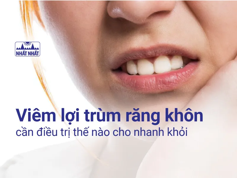 viêm lợi trùm răng khôn
