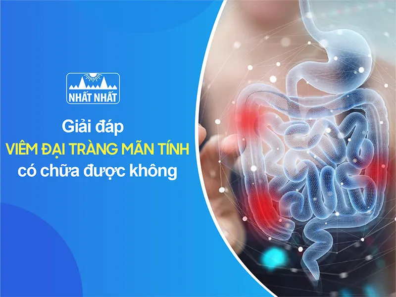viêm đại tràng mãn tính có chữa được không