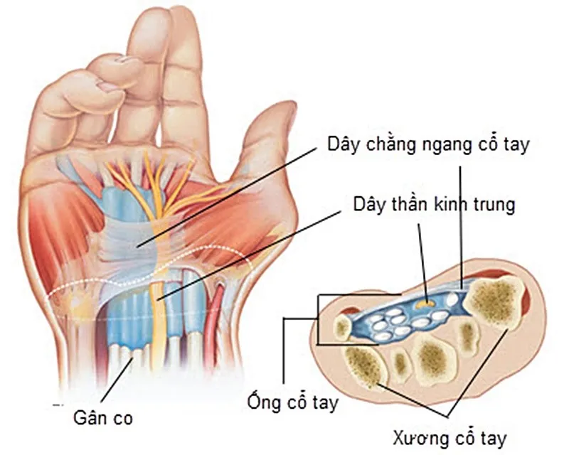 đau cổ tay lâu ngày không khỏi
