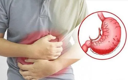 Đau dạ dày là tình trạng phổ biến