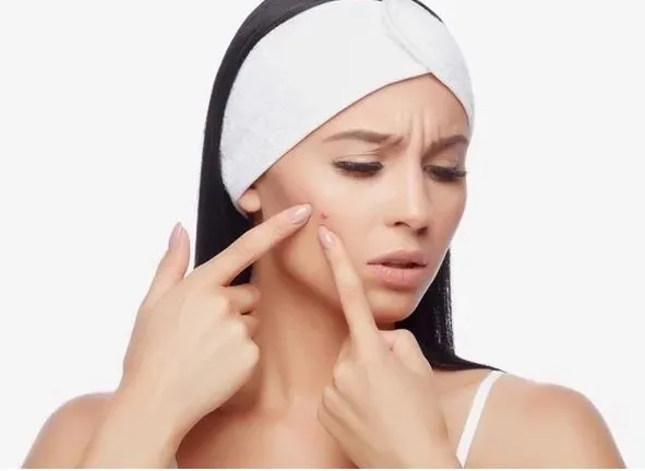 giảm mụn tại nhà