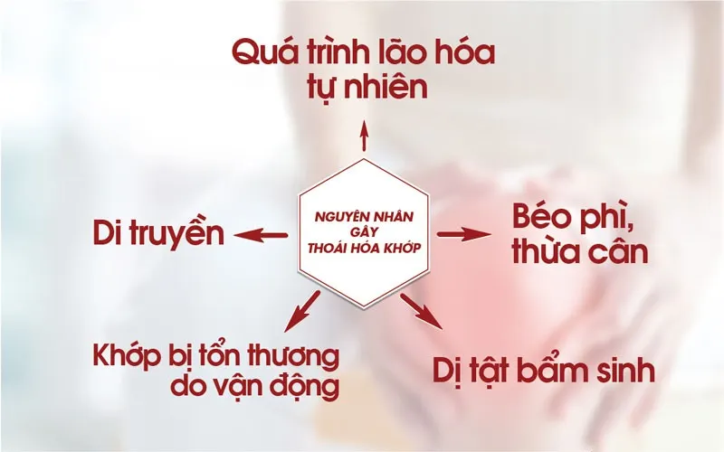 thoái hóa khớp gối 