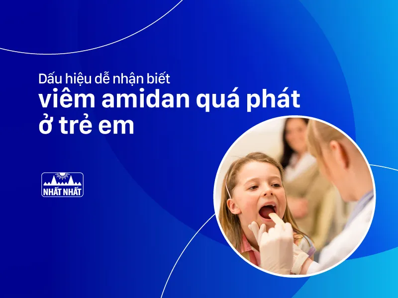 viêm amidan quá phát ở trẻ em